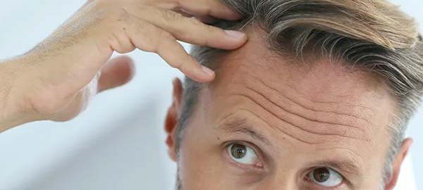 best hair transplant in haldwani