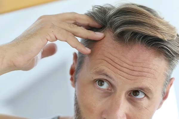 best hair transplant in haldwani