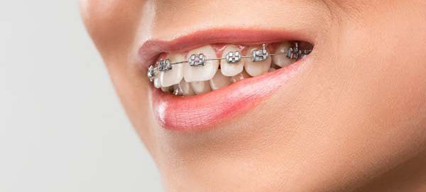 Orthodontist in Haldwani